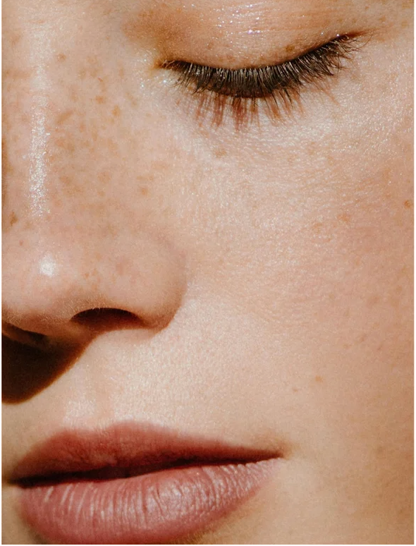 Close-up of a freckled face showcasing smooth skin and natural beauty with soft lips.